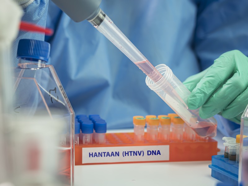 Cientista da saúde realiza pesquisa para analisar a epidemia de hantavírus no laboratório.
