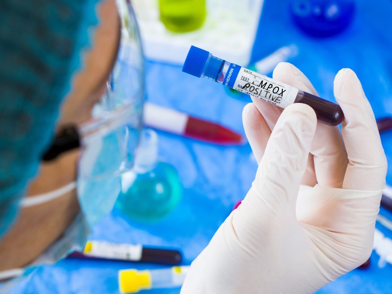 Profissional de saúde conversando com uma paciente durante consulta médica, conceito de identificação de sintomas e orientação sobre a mpox.