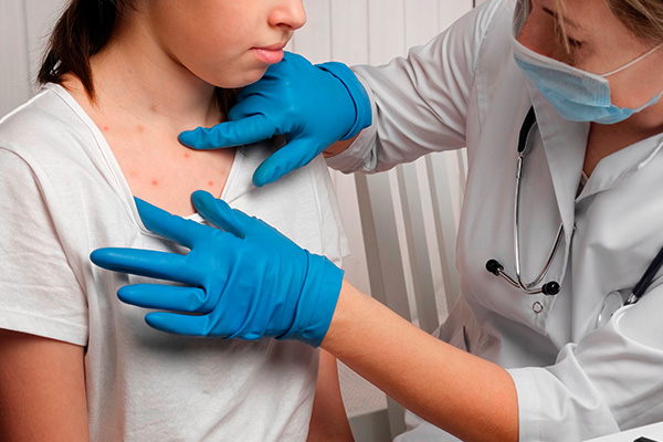 Lesiones cutáneas características de la viruela símica (mpox)